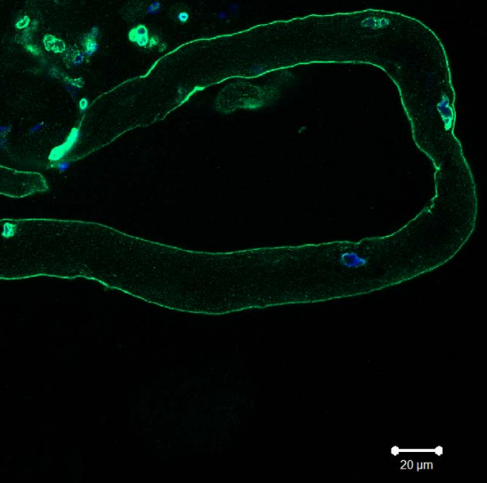 xeno muwcle fiber